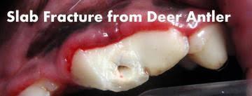 Slab Fracture from Deer Antler, Dog Tooth Injury